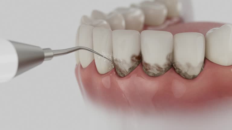 Trusted Tooth Extraction service in Trenton, NJ - Dentist Open Now